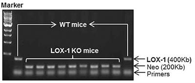 LOX-1 Deletion Attenuates Myocardial Fibrosis in the Aged Mice, Particularly Those With Hypertension